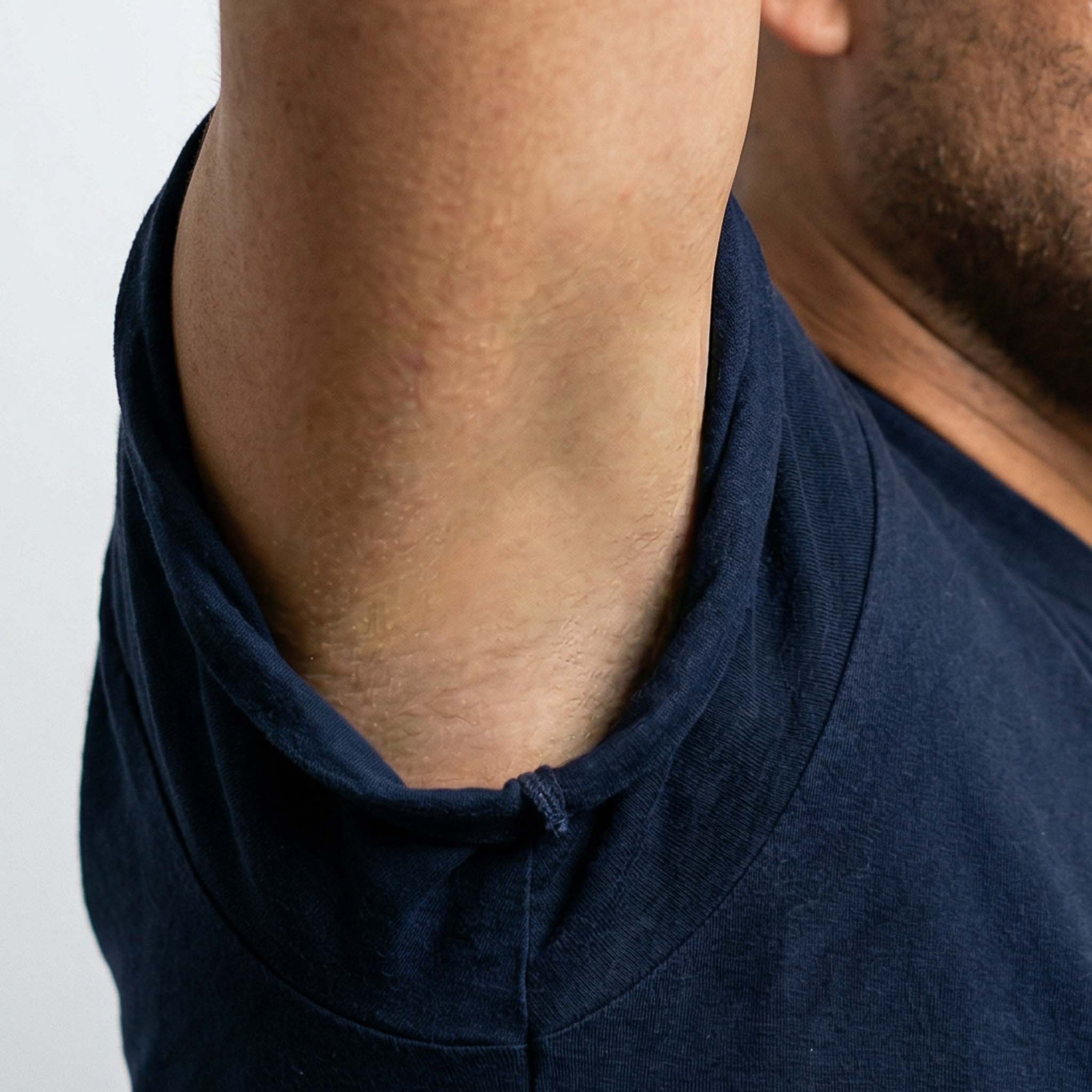 After — clean natural skin